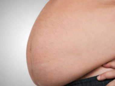 Best Ways to Reduce Belly Fat Naturally